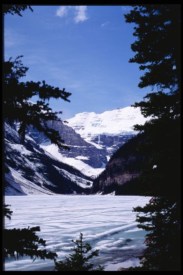 276033 Banff National Park, Lake Louise A4 Photo Print