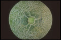 322092 Melon Top A4 Photo Print