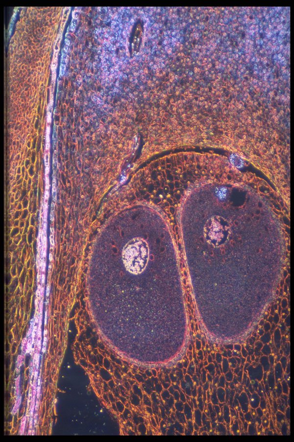 430047 Pine, Archegonia Before Fecondation A4 Photo Print