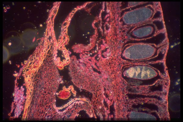 430048 Moss, Marchantia, Antheredium, Transversal Cut A4 Photo Print