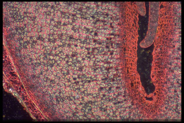 430051 Ricinus, Extremity Of The Embryo A4 Photo Print