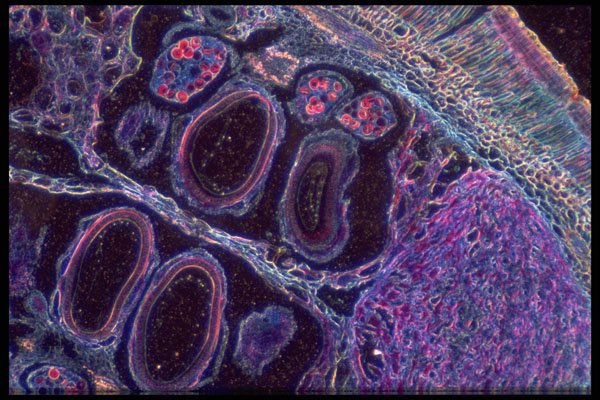 430054 Marsilea, Sporocarp, Transversal Cut A4 Photo Print