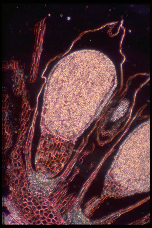 430098 Marchantia, Mature Sporophyte A4 Photo Print
