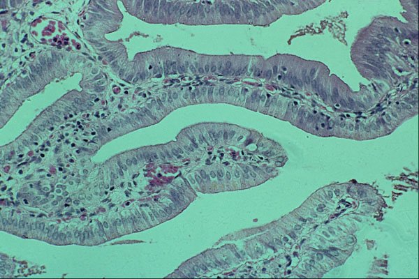 440000 Columnar Epithelium (gall Bladder) A4 Photo Print