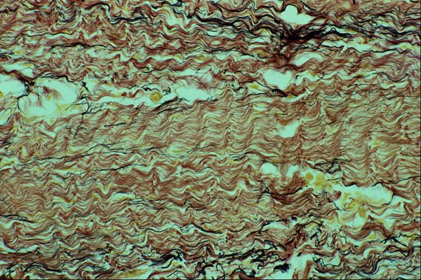 440001 Collagen Fiber A4 Photo Print