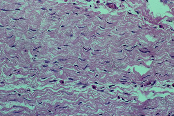 440002 Collagen Fibers A4 Photo Print