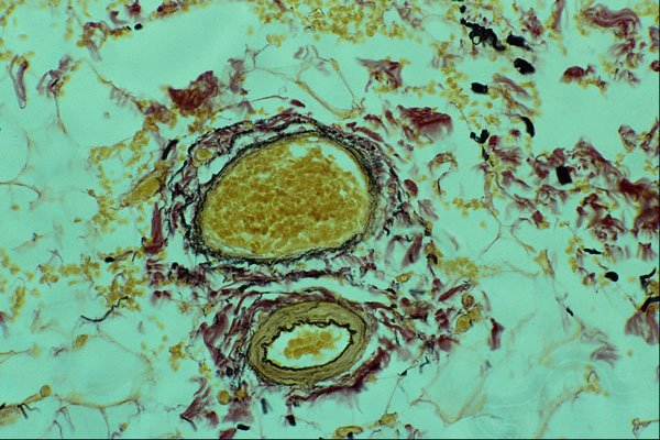 440003 Elastic Fibers In Blood Vessels A4 Photo Print