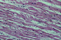 440006 Cardiac Muscle (heart) A4 Photo Print