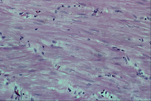 440007 Longitudinal Smooth Muscle (intestine) A4 Photo Print
