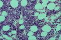 440009 Bone Marrow (decalcified Vertebrae) A4 Photo Print