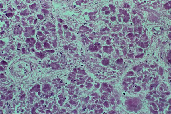 440010 Thymus, Adult, 45 Years A4 Photo Print