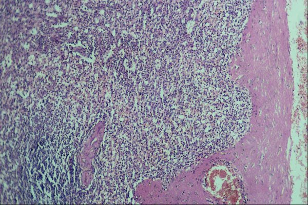 440011 Spleen A4 Photo Print