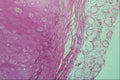 440012 Bronchus A4 Photo Print