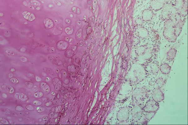 440012 Bronchus A4 Photo Print