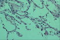 440013 Lung A4 Photo Print