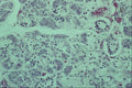 440015 Submandibular Salivary Gland A4 Photo Print
