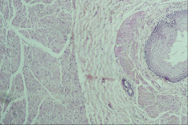 440017 Oesophagus A4 Photo Print