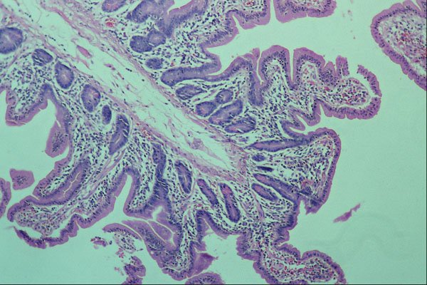 440018 Finger Villi (jejunum) A4 Photo Print