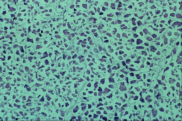 440019 Pancreas A4 Photo Print