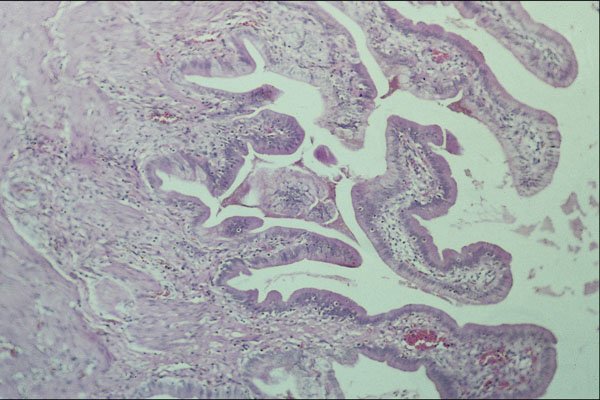 440022 Gall Bladder A4 Photo Print