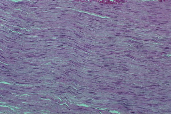 440025 Ganglion A4 Photo Print