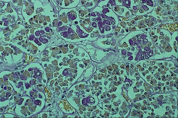 440029 Pituitary Gland A4 Photo Print