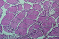 440030 Thyroid A4 Photo Print