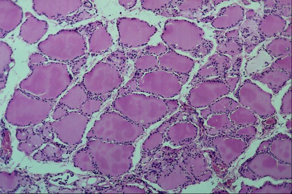 440030 Thyroid A4 Photo Print