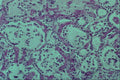 440031 Infant Thyroid A4 Photo Print