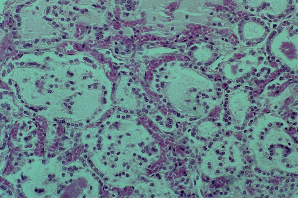 440031 Infant Thyroid A4 Photo Print