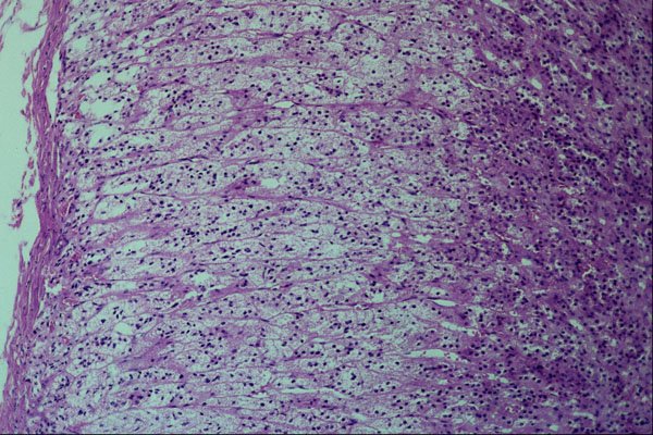 440032 Adrenal Cortex A4 Photo Print