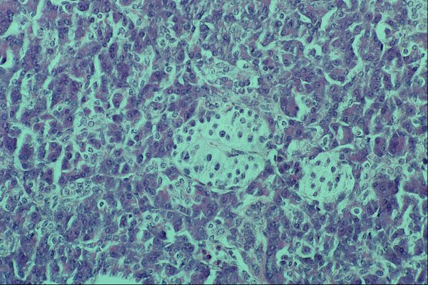 440034 Pancreas A4 Photo Print