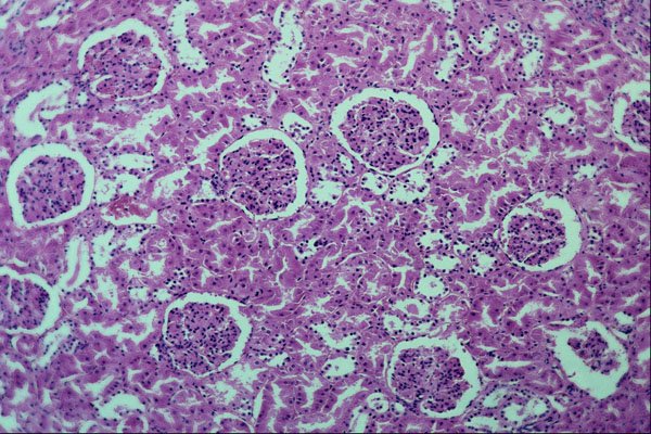 440035 Kidney Glomeruli A4 Photo Print