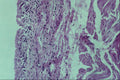 440036 Bladder A4 Photo Print