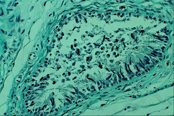440037 Testis A4 Photo Print