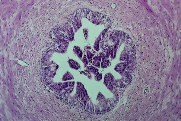 440038 Vas Deferens A4 Photo Print