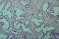 440039 Prostate A4 Photo Print