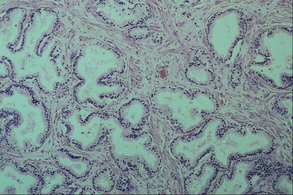 440039 Prostate A4 Photo Print