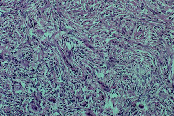 440040 Ovary A4 Photo Print