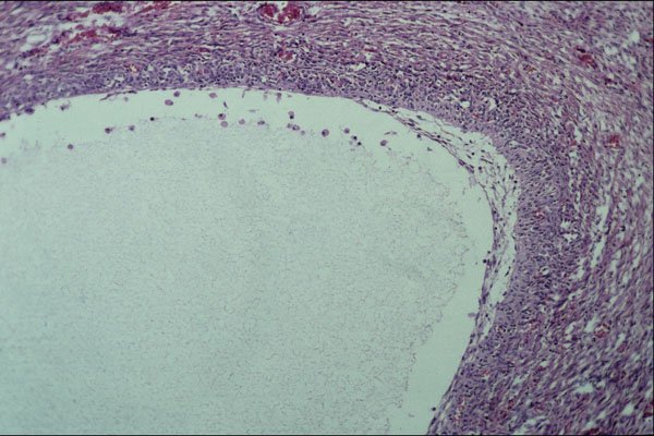 440041 Ovary A4 Photo Print