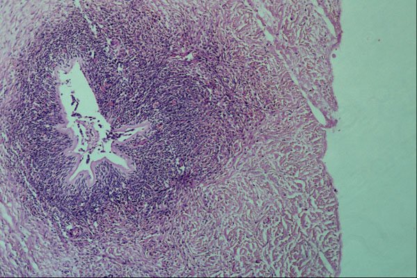 440042 Ovary A4 Photo Print