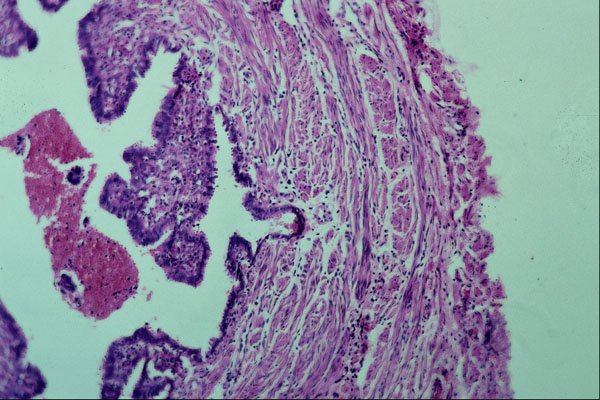 440043 Fallopian Tube A4 Photo Print