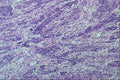 440044 Myometrium (uterus) A4 Photo Print