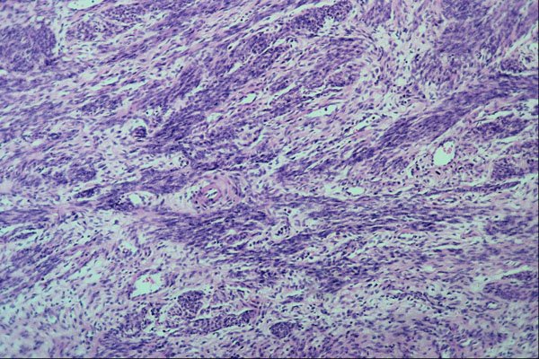 440044 Myometrium (uterus) A4 Photo Print