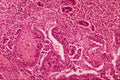 440045 Endometrium, 1st Day Menstrual A4 Photo Print