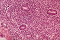 440046 Endometrium Early Proliferative Phase A4 Photo Print