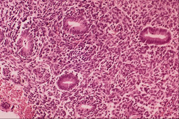440046 Endometrium Early Proliferative Phase A4 Photo Print