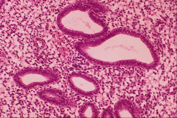 440047 Endometrium, 14th Day A4 Photo Print