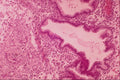 440048 Endometrium, 28th Day A4 Photo Print