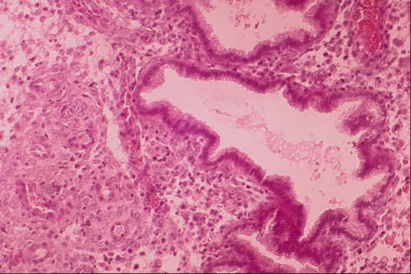 440048 Endometrium, 28th Day A4 Photo Print